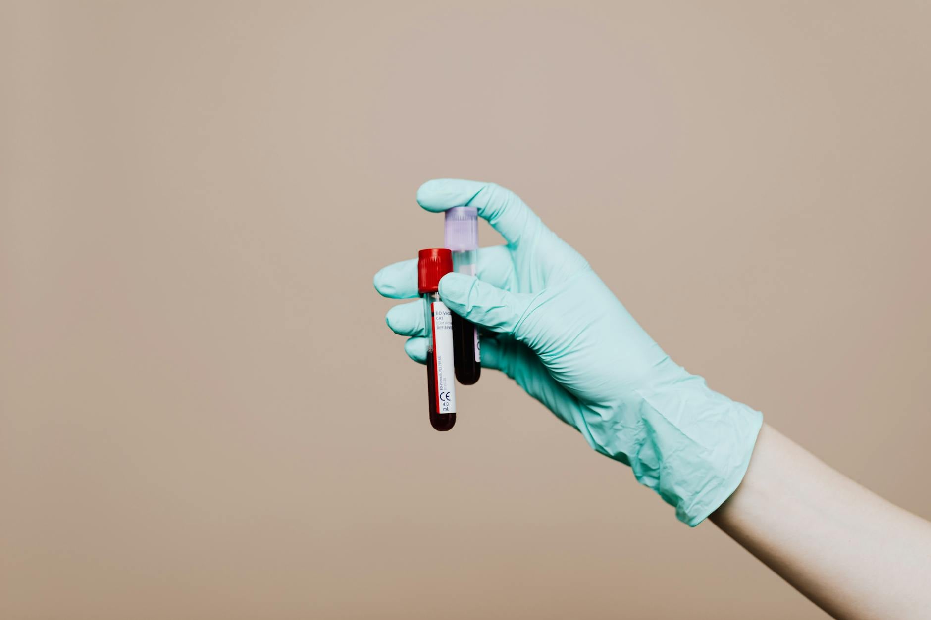 Protéine c-réactive apparaît lors d inflammation : guide