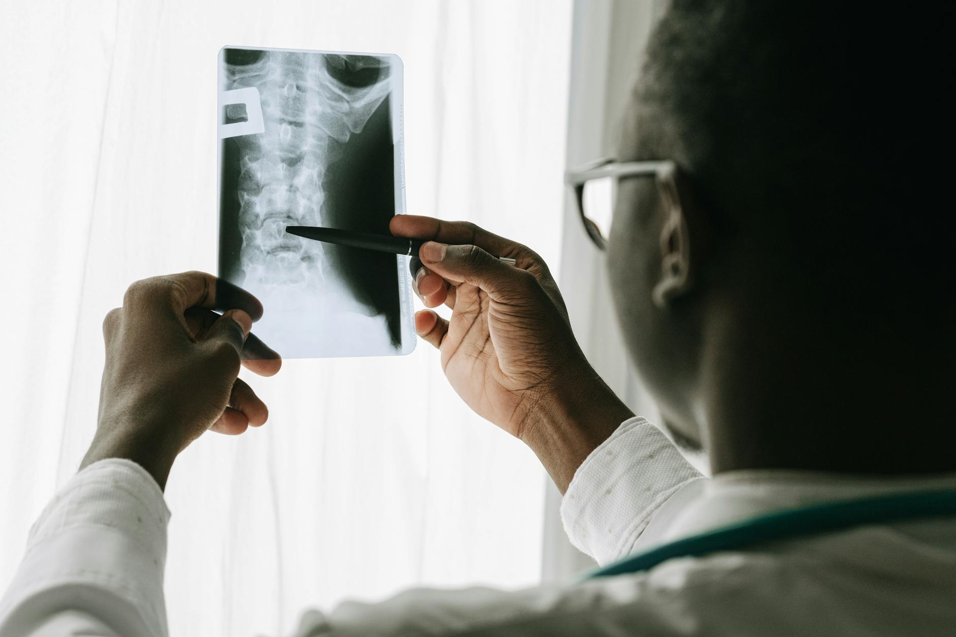 Côte n pas forcément fêlée : reconnaître et gérer la douleur