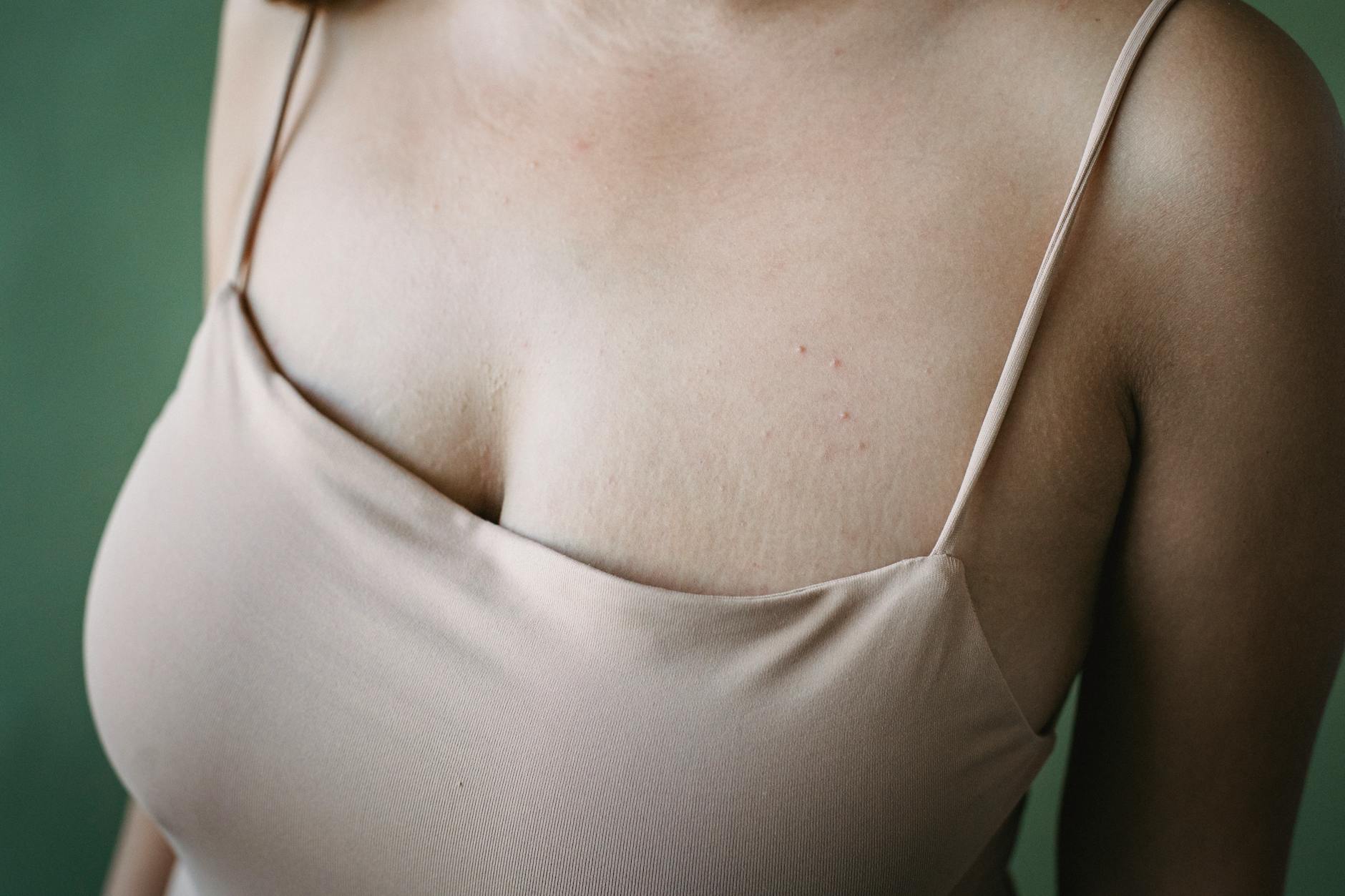 Cette kératose pilaire se dévoile sans gravité : bons gestes