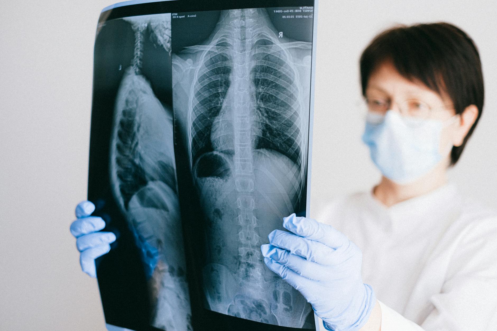 Tout monde peut attraper tuberculose : repères et prévention