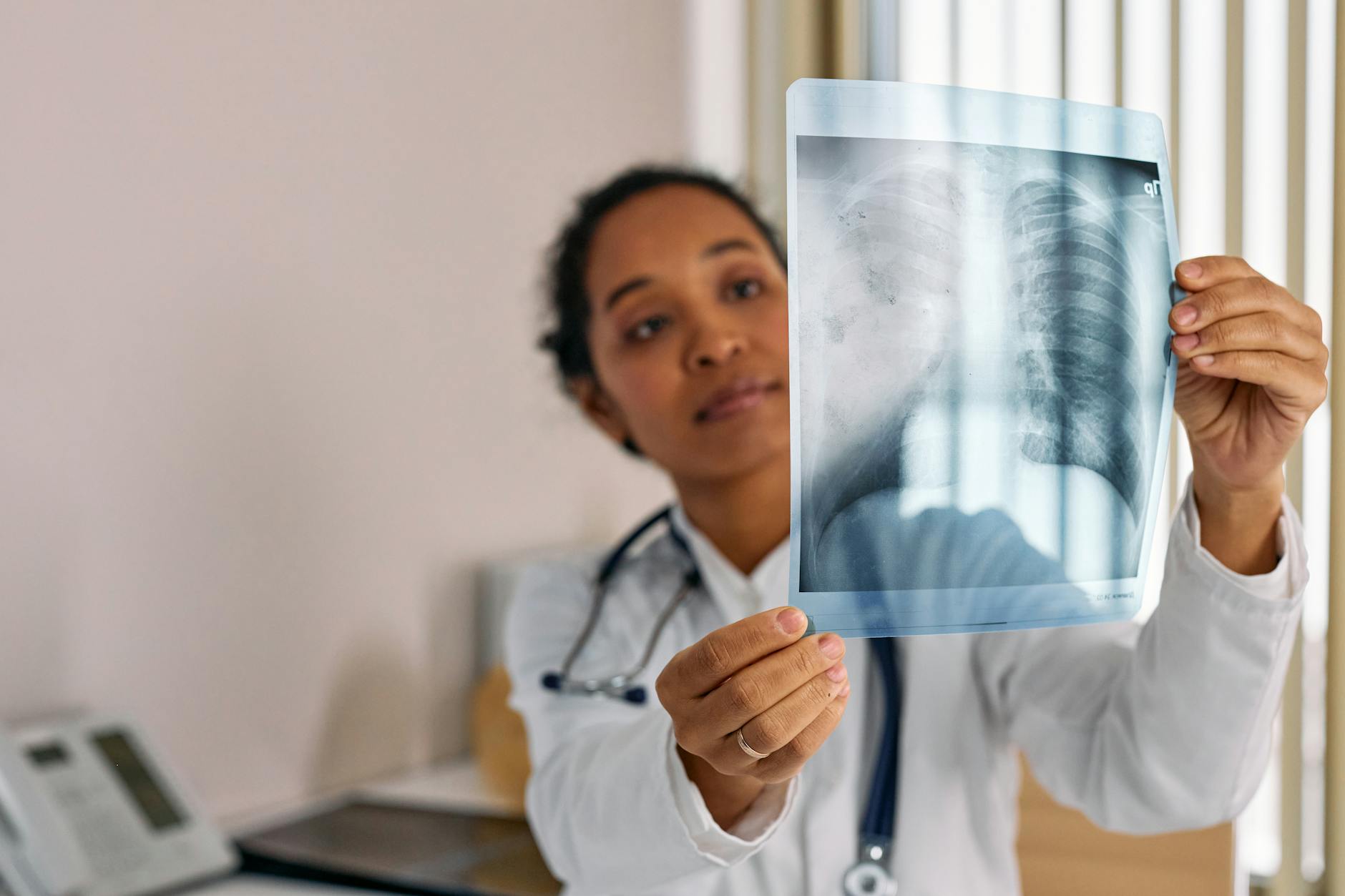 Tuberculose : repères pratiques sur une infection respiratoire