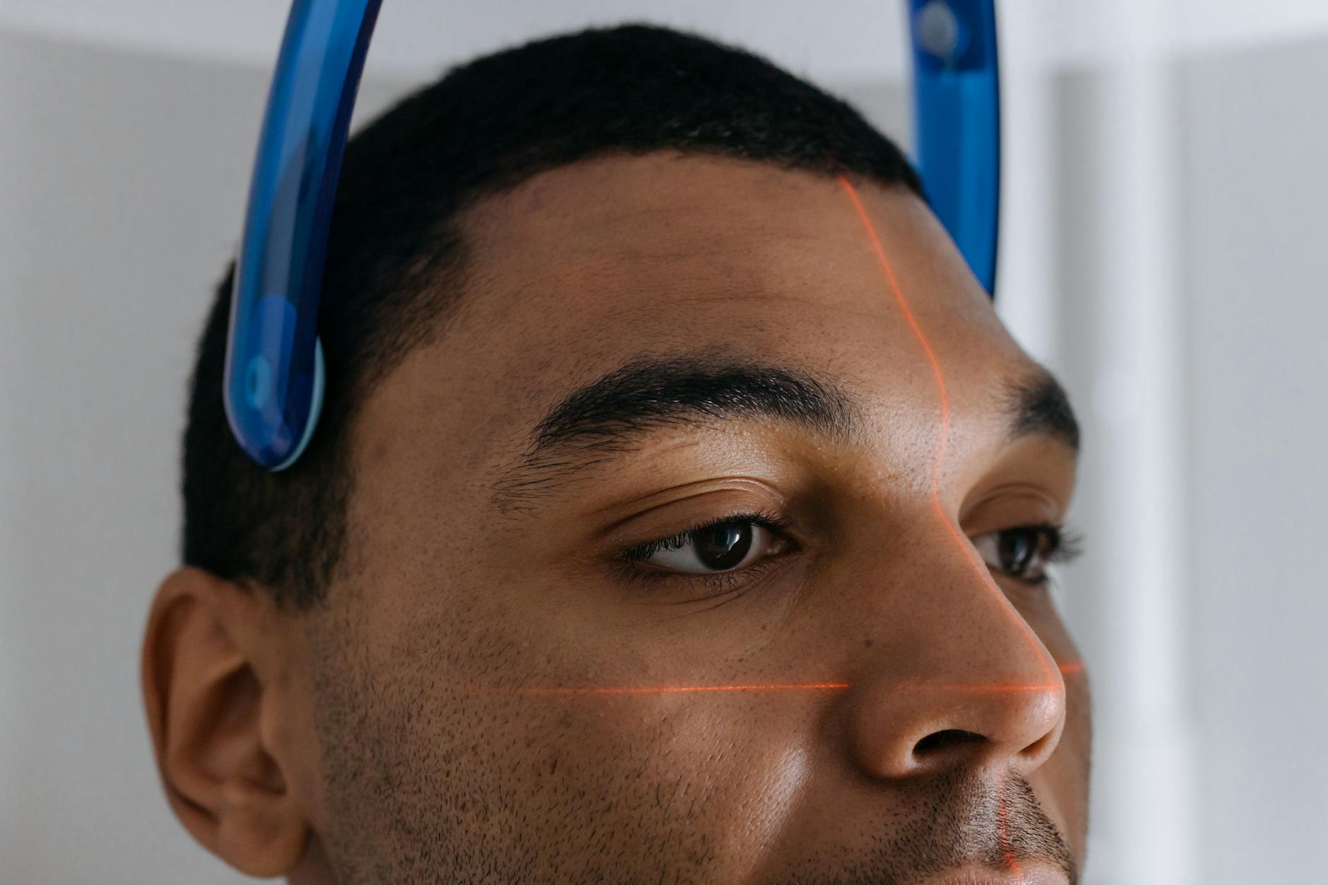 Dispositif robotise de greffe capillaire en clinique specialisee